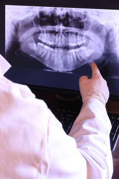 Best Chipped Tooth Repair Near Me  in Klamath Falls, OR