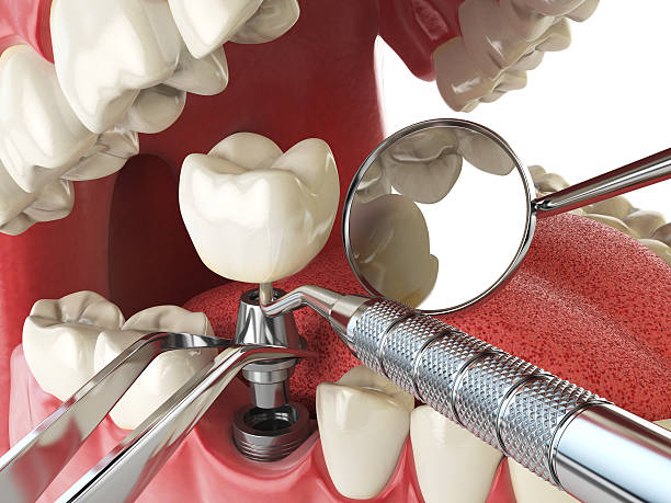 Best Emergency Tooth Extraction  in Klamath Falls, OR